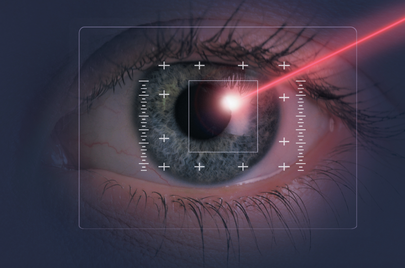 LASIK tech overlay on an eye